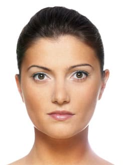 After Image: Facelift - front