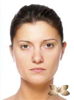 Before Image: Facelift - front