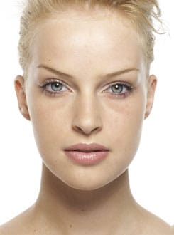 Before Image: Facelift 3 - front